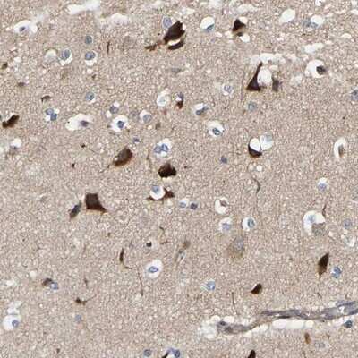 Immunohistochemistry-Paraffin: CCDC155 Antibody [NBP1-81992]