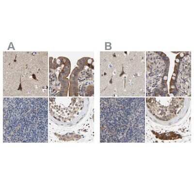 Immunohistochemistry-Paraffin: CCDC155 Antibody [NBP1-81992]