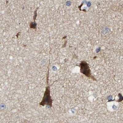 Immunohistochemistry-Paraffin: CCDC155 Antibody [NBP1-81992]