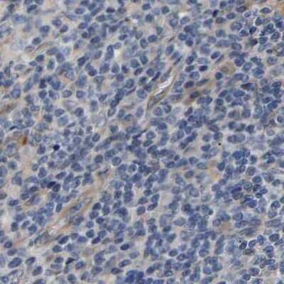 Immunohistochemistry-Paraffin: CCDC155 Antibody [NBP1-81992]