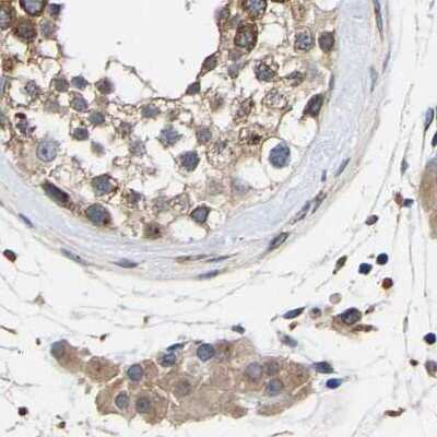 Immunohistochemistry-Paraffin: CCDC155 Antibody [NBP1-81992]