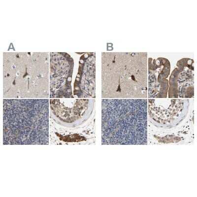 Immunohistochemistry-Paraffin: CCDC155 Antibody [NBP1-81993]