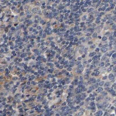 Immunohistochemistry-Paraffin: CCDC155 Antibody [NBP1-81993]