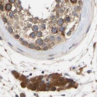 Immunohistochemistry-Paraffin: CCDC155 Antibody [NBP1-81993]