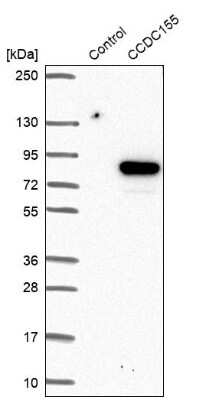 Western Blot: CCDC155 Antibody [NBP1-81993]