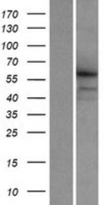 Western Blot: CCDC155 Overexpression Lysate [NBP2-05535]