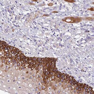 Immunohistochemistry-Paraffin: CCDC157 Antibody [NBP1-85831]