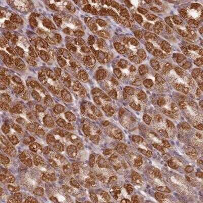 Immunohistochemistry-Paraffin: CCDC159 Antibody [NBP1-94186]