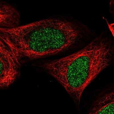 Immunocytochemistry/ Immunofluorescence: CCDC16 Antibody [NBP1-88164]