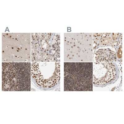 Immunohistochemistry-Paraffin: CCDC16 Antibody [NBP1-88164]