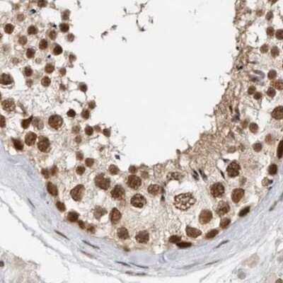 Immunohistochemistry-Paraffin: CCDC16 Antibody [NBP1-88164]