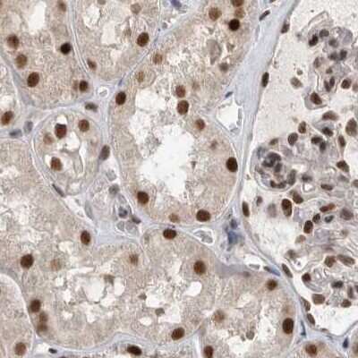 Immunohistochemistry-Paraffin: CCDC16 Antibody [NBP1-88164]
