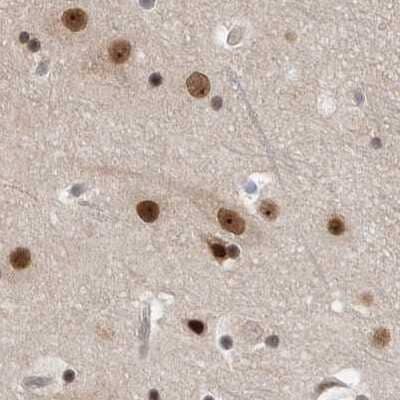 Immunohistochemistry-Paraffin: CCDC16 Antibody [NBP1-88164]