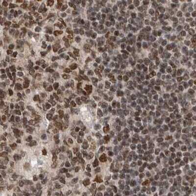 Immunohistochemistry-Paraffin: CCDC16 Antibody [NBP1-88164]