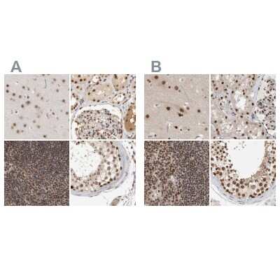 Immunohistochemistry-Paraffin: CCDC16 Antibody [NBP1-88165]