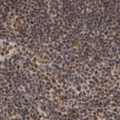 Immunohistochemistry-Paraffin: CCDC16 Antibody [NBP1-88165]