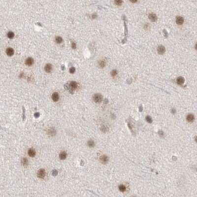 Immunohistochemistry-Paraffin: CCDC16 Antibody [NBP1-88165]