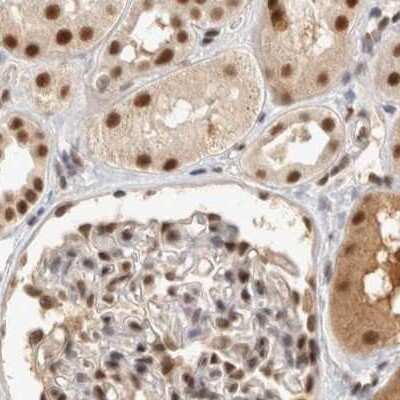 Immunohistochemistry-Paraffin: CCDC16 Antibody [NBP1-88165]