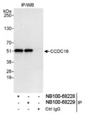 Immunoprecipitation: CCDC16 Antibody [NB100-68228]