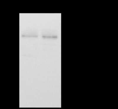 Immunoprecipitation: CCDC16 Antibody [NBP2-97135]