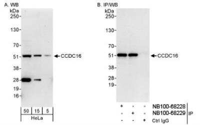 Western Blot: CCDC16 Antibody [NB100-68229]