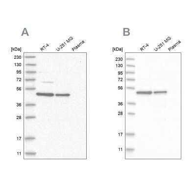 Western Blot: CCDC16 Antibody [NBP1-88164]