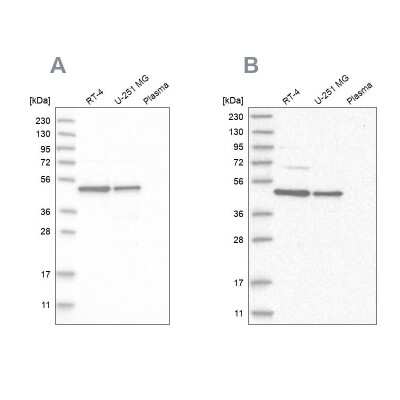 Western Blot: CCDC16 Antibody [NBP1-88165]