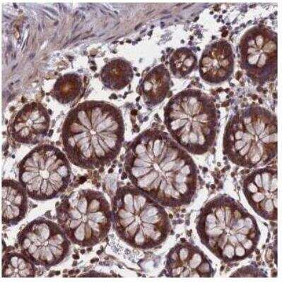 Immunohistochemistry: CCDC160 Antibody [NBP2-31104]