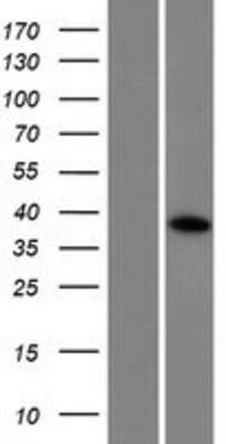 Western Blot: CCDC160 Overexpression Lysate [NBP2-09336]