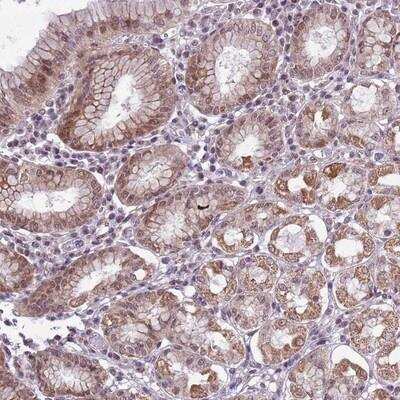 Immunohistochemistry-Paraffin: CCDC166 Antibody [NBP2-14496]