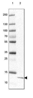 Western Blot: CCDC167 Antibody [NBP1-94107]