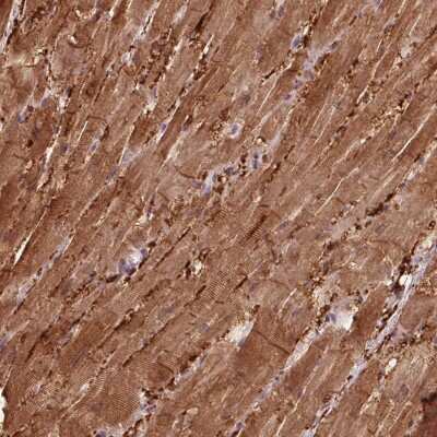 Immunohistochemistry: CCDC168 Antibody [NBP2-49291]