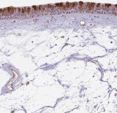 Immunohistochemistry-Paraffin: CCDC168 Antibody [NBP2-14629]