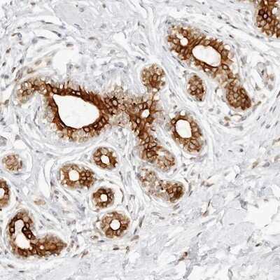 Immunohistochemistry-Paraffin: CCDC17 Antibody [NBP1-93860]