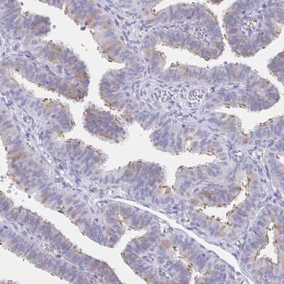 Immunohistochemistry-Paraffin: CCDC17 Antibody [NBP1-93860]