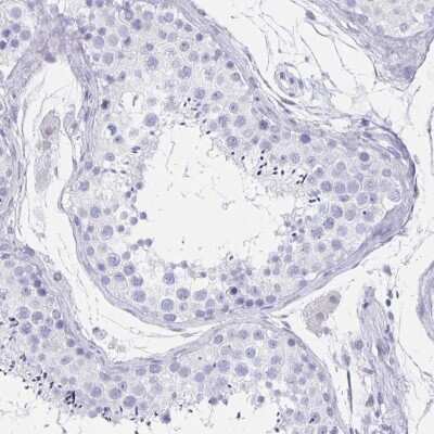 Immunohistochemistry-Paraffin: CCDC17 Antibody [NBP1-93860]