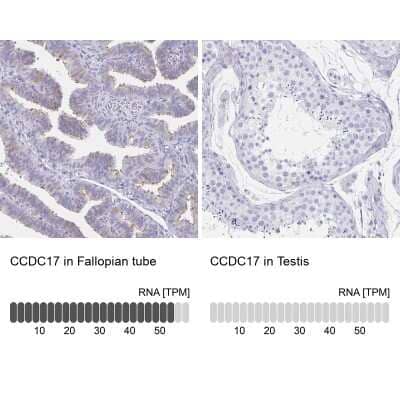 Immunohistochemistry-Paraffin: CCDC17 Antibody [NBP1-93860]