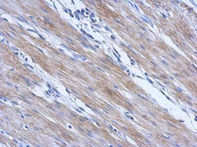 Immunohistochemistry-Paraffin: CCDC17 Antibody [NBP2-15745]