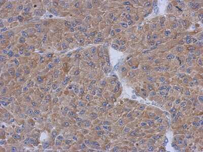 Immunohistochemistry-Paraffin: CCDC17 Antibody [NBP2-15746]