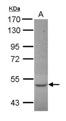 Western Blot: CCDC17 Antibody [NBP2-15745]