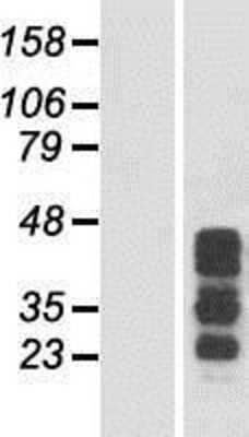 Western Blot: CCDC17 Overexpression Lysate [NBP2-05356]