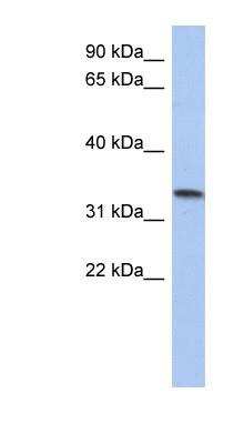 Western Blot: CCDC172 Antibody [NBP1-56323]