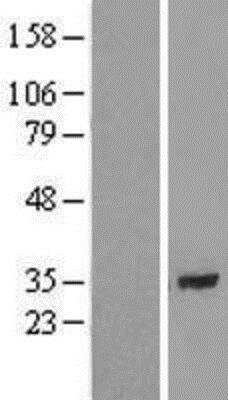 Western Blot: CCDC172 Overexpression Lysate [NBL1-08091]