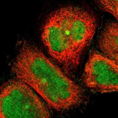 Immunocytochemistry/ Immunofluorescence: CCDC176 Antibody [NBP1-91199]