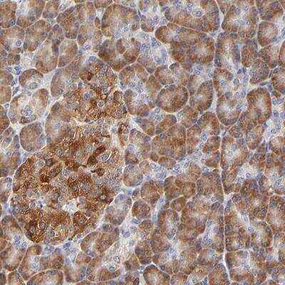 Immunohistochemistry: CCDC176 Antibody [NBP1-91200]