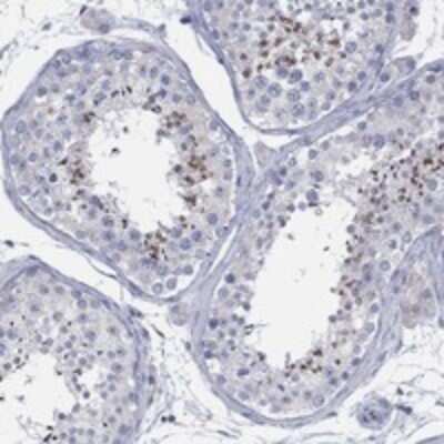 Immunohistochemistry-Paraffin: CCDC176 Antibody [NBP3-17354]