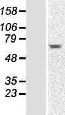 Western Blot: CCDC176 Overexpression Lysate [NBP2-06248]