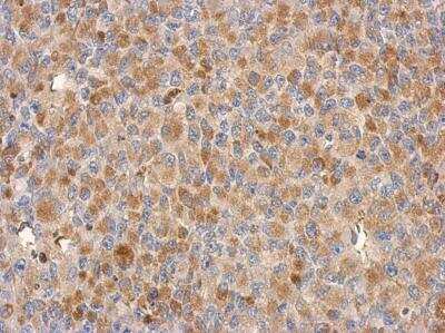 Immunohistochemistry-Paraffin: CCDC178 Antibody [NBP2-15637]