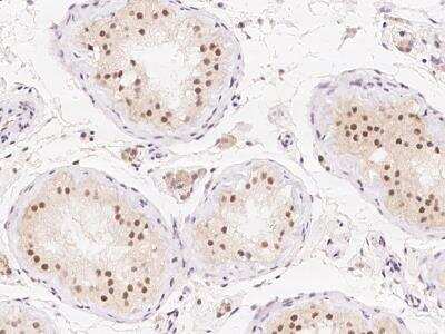 Immunohistochemistry-Paraffin: CCDC178 Antibody [NBP3-06031]