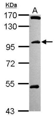 Western Blot: CCDC178 Antibody [NBP2-15637]